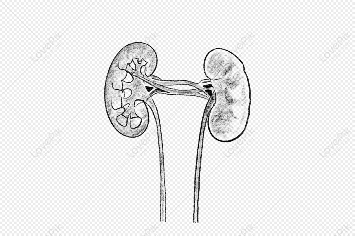 Drawing of a transplanted kidney inside an outline of the abdomen - Media  Asset - NIDDK