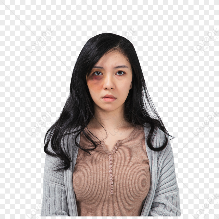 Woman Bruised By Domestic Violence PNG Transparent And Clipart Image ...