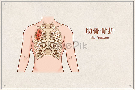 肋骨骨折設計模板素材 肋骨骨折png矢量背景圖片免費下載 Lovepik