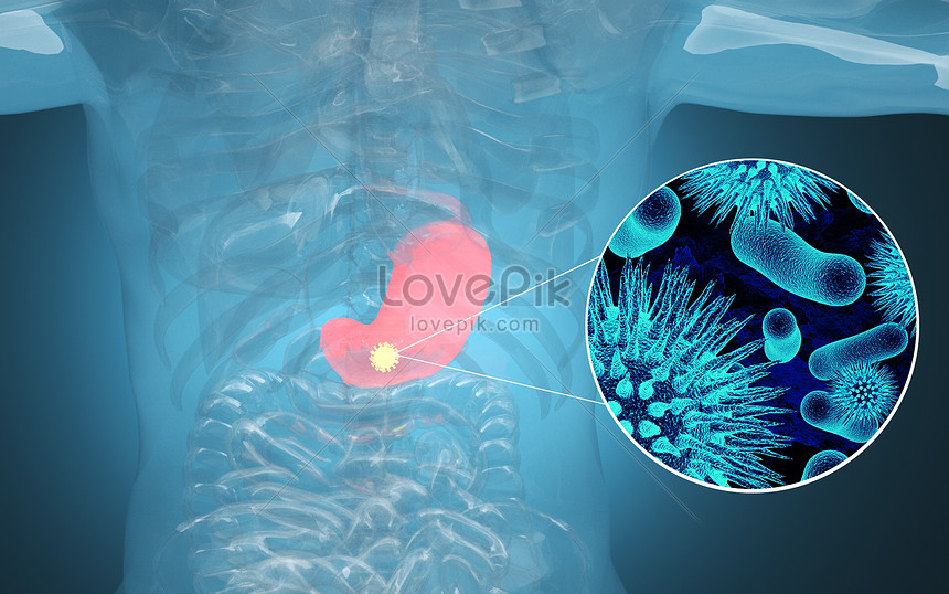 Human stomach diseases creative image_picture free download 401800146 ...