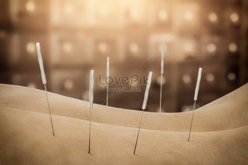 Acupuncture || Arogyadhama Service