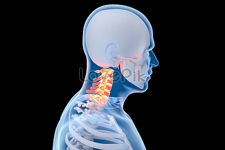 Cervical vertebra pain creative image_picture free download 500810975 ...