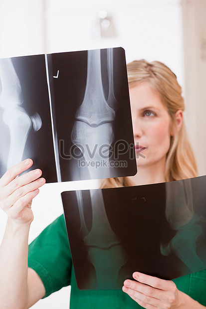 Dokter Wanita Melihat Gambar X Ray Gambar Unduh Gratis Foto 501523172 Format Gambar Jpg Lovepik Com