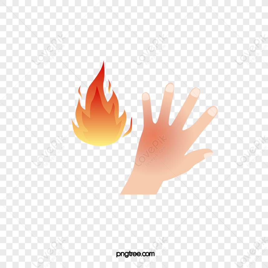 Cartoon Hand Burns,skin Problems,problems,hospital Icon PNG Free ...