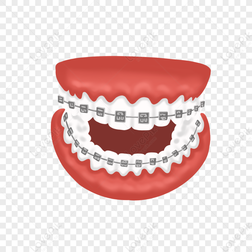 dental braces clipart free